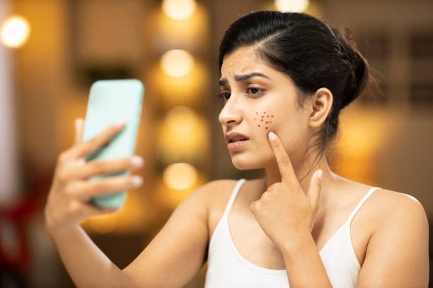 Skincare Services
